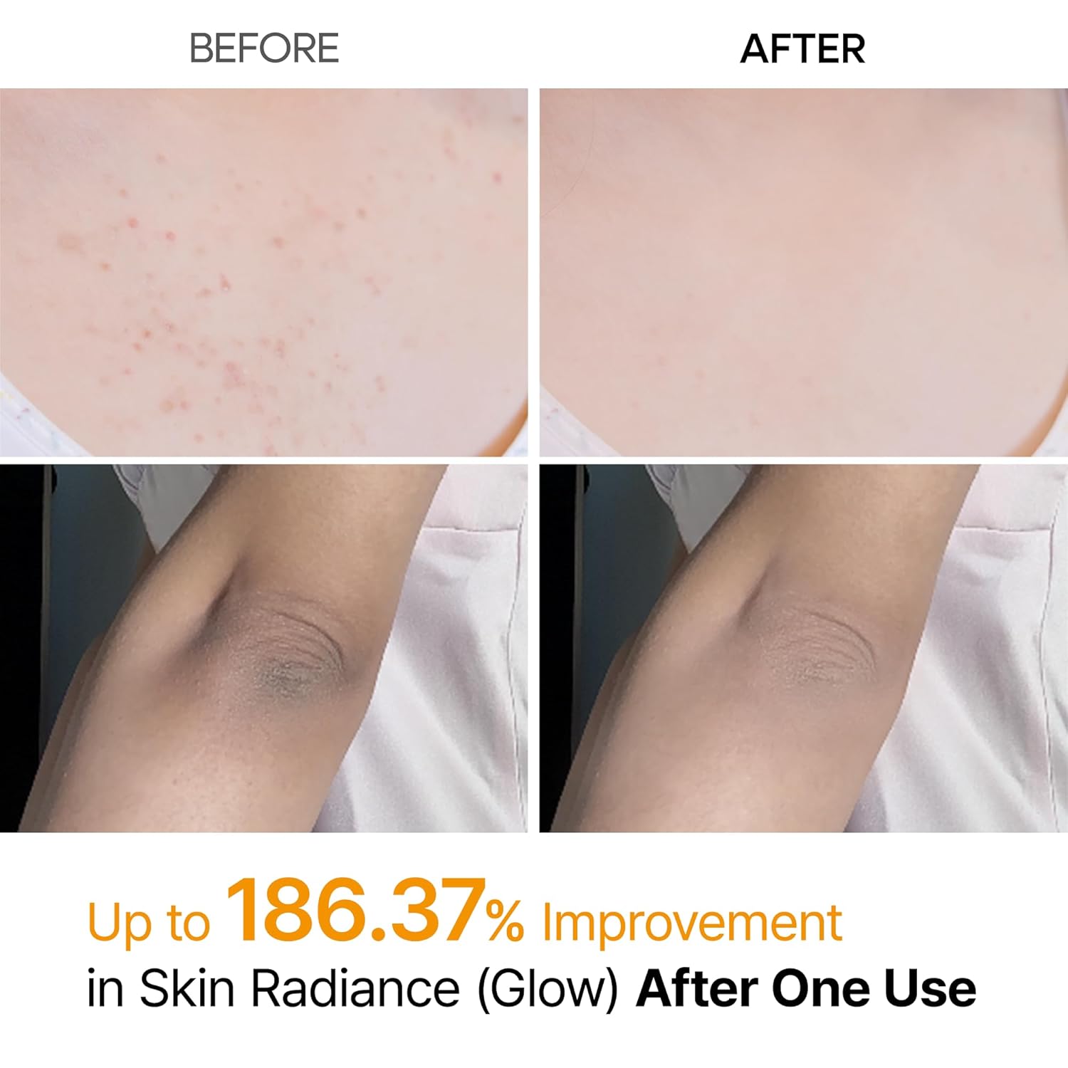 Dr. Melaxin Exfoliating Kojic Acid Tumeric Spray